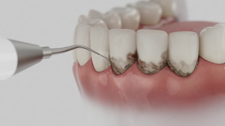 Reliable Teeth Cleaning And Checkup contractor in Itawamba County County, MS by Dentist Open Now